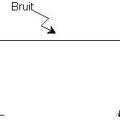 bruit1.jpeg
